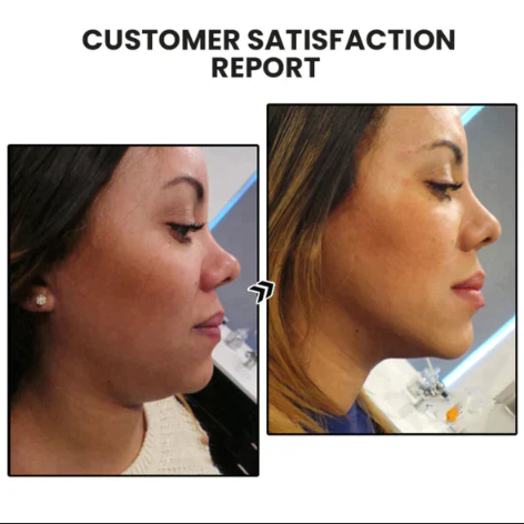 （🔥LAST DAY SALE-50% OFF) Peachlife™ Miniyou Lymphatic Drainage Earrings