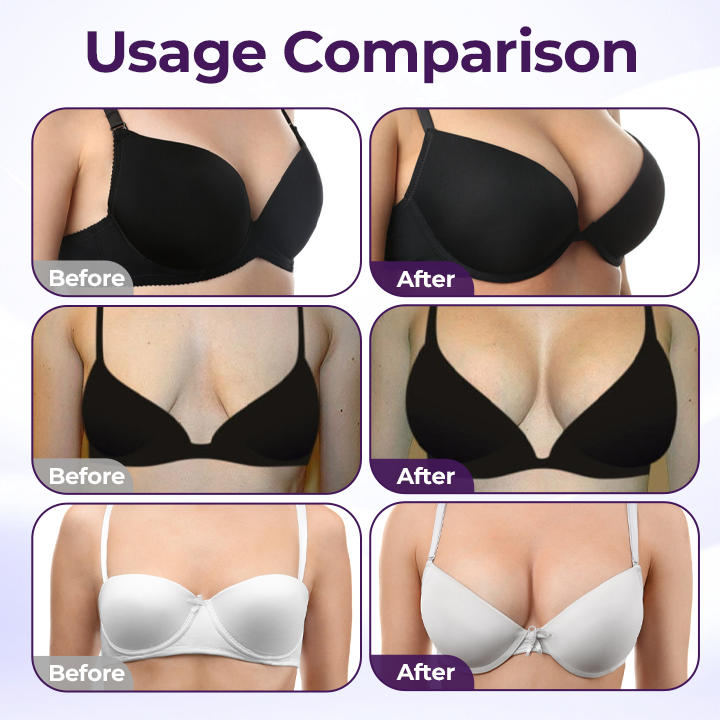 Acezozla® Maxcurve Lift & Plump Bust Cream