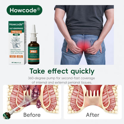 Howcode® Fast Hemorrhoid PRO Spray