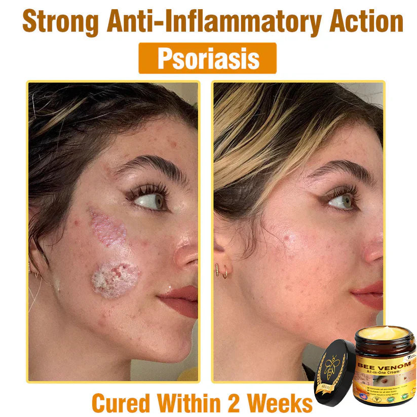 Bee Venom All-in-One Cream US Dermatologist Approved🐝